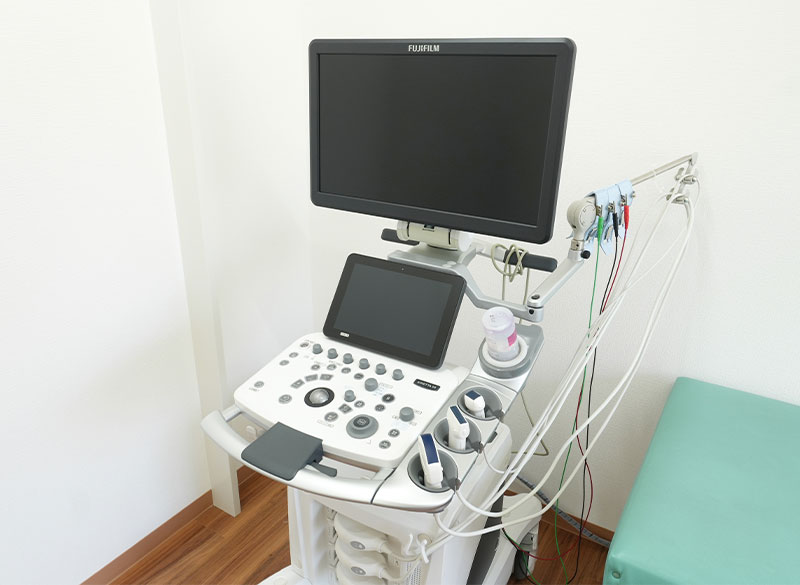 超音波検査装置